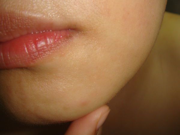 AMIINO安美諾高效抗痘凝膠