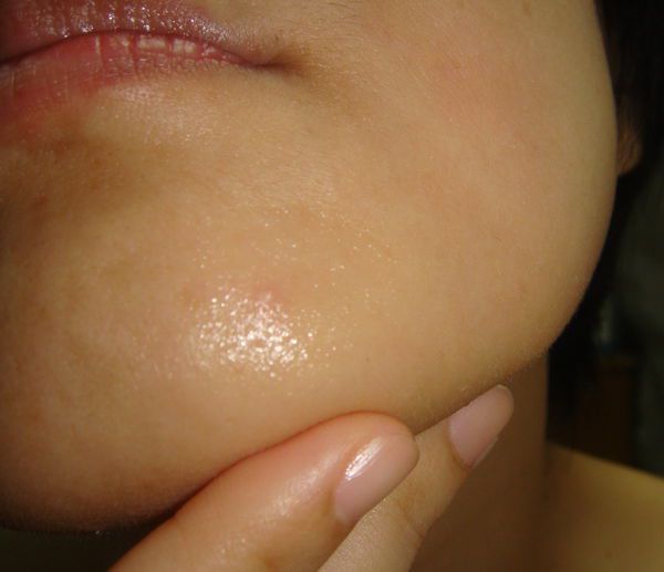 AMIINO安美諾高效抗痘凝膠