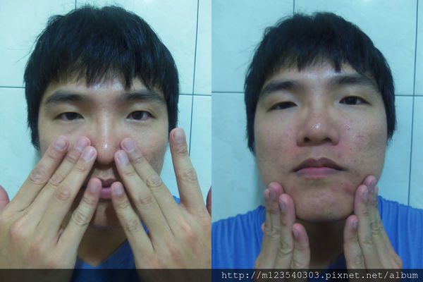 AMIINO安美諾高效抗痘凝膠