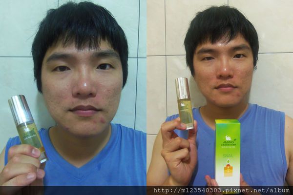 AMIINO安美諾高效抗痘凝膠