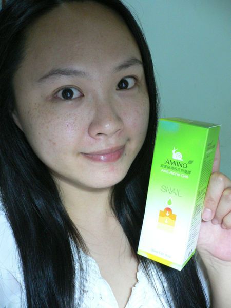 AMIINO安美諾高效抗痘凝膠