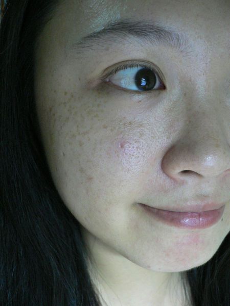 AMIINO安美諾高效抗痘凝膠