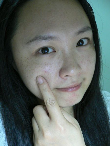 AMIINO安美諾高效抗痘凝膠