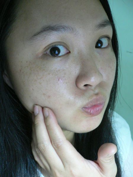 AMIINO安美諾高效抗痘凝膠