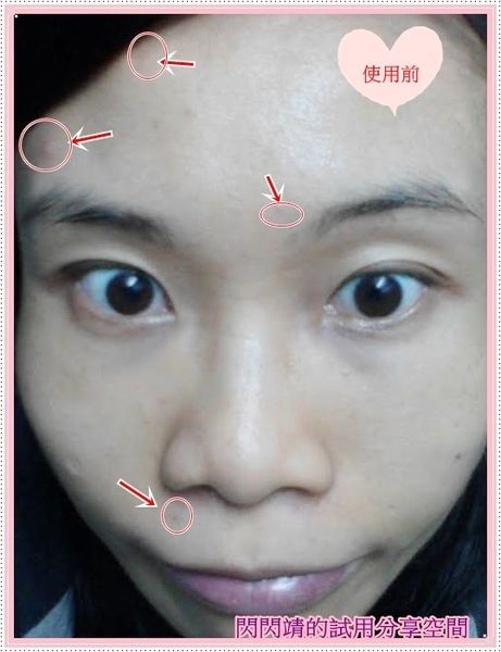 AMIINO安美諾高效抗痘凝膠