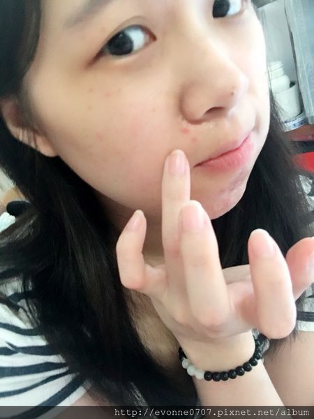 AMIINO安美諾高效抗痘凝膠