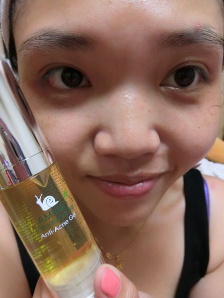 AMIINO安美諾高效抗痘凝膠