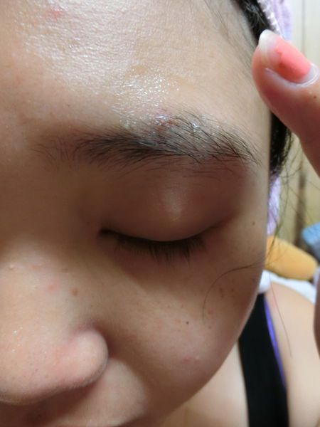 AMIINO安美諾高效抗痘凝膠