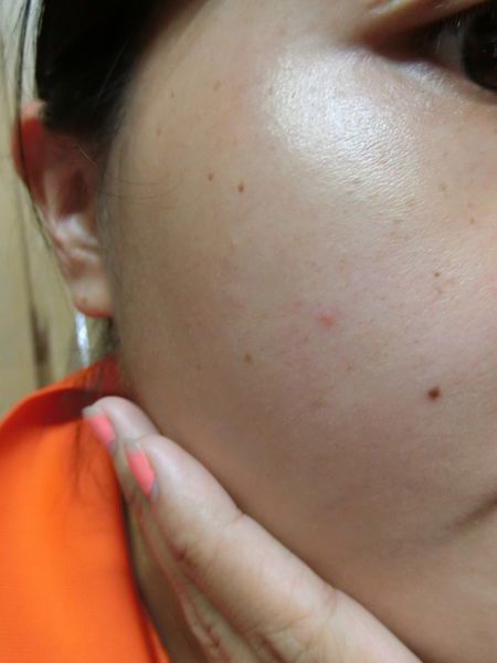 AMIINO安美諾高效抗痘凝膠