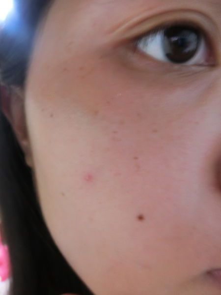 AMIINO安美諾高效抗痘凝膠