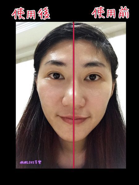 AMIINO安美諾高效抗痘凝膠