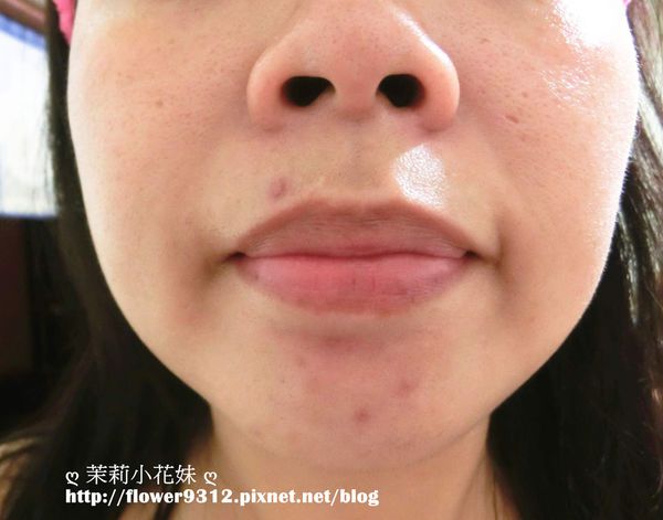 AMIINO安美諾高效抗痘凝膠