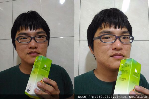 AMIINO安美諾高效抗痘凝膠