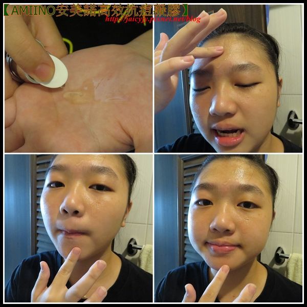 AMIINO安美諾高效抗痘凝膠