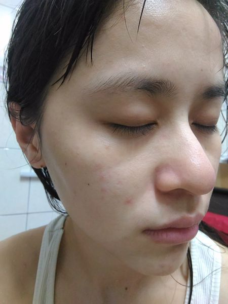 AMIINO安美諾高效抗痘凝膠