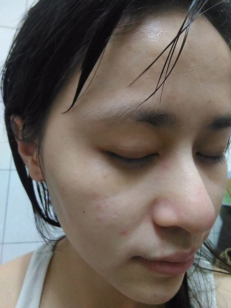 AMIINO安美諾高效抗痘凝膠