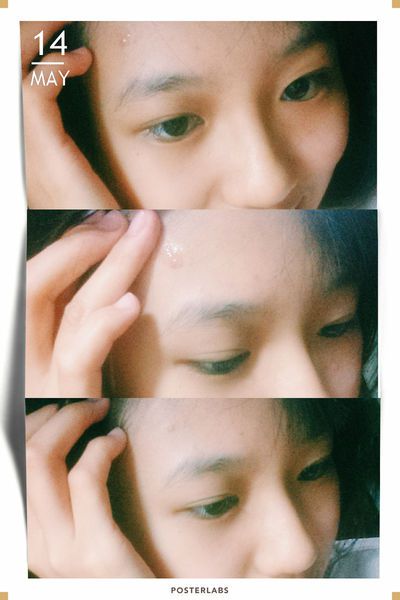 AMIINO安美諾高效抗痘凝膠