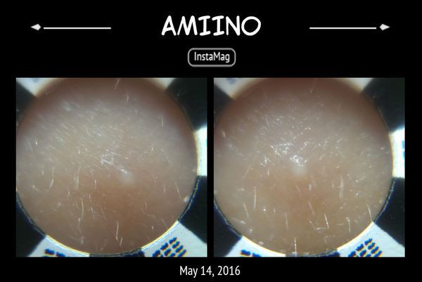 AMIINO安美諾高效抗痘凝膠