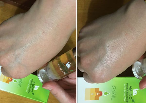 AMIINO安美諾高效抗痘凝膠