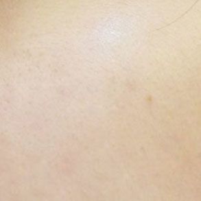 AMIINO安美諾高效抗痘凝膠