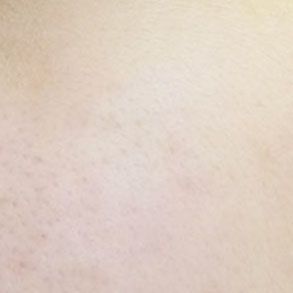 AMIINO安美諾高效抗痘凝膠