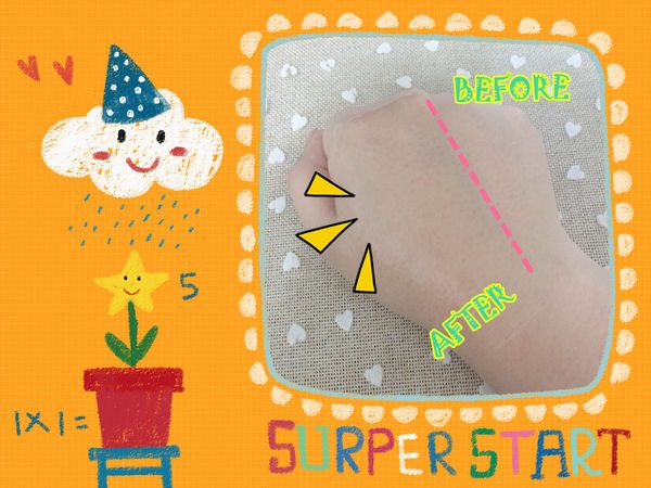 AMIINO安美諾高效抗痘凝膠