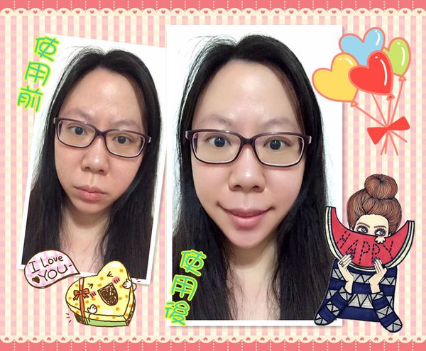 AMIINO安美諾高效抗痘凝膠