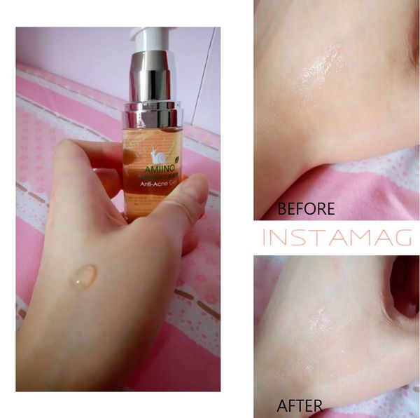 AMIINO安美諾高效抗痘凝膠