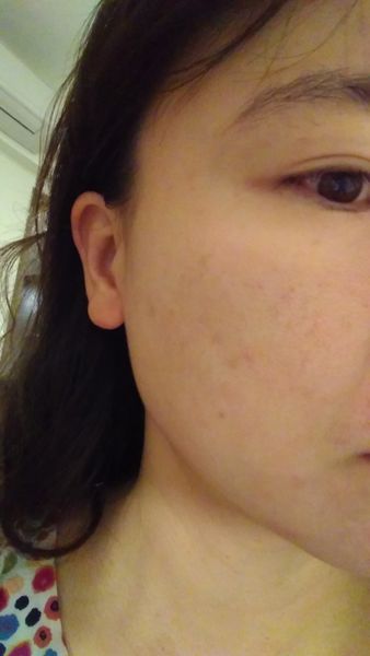 AMIINO安美諾高效抗痘凝膠