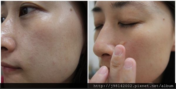 AMIINO安美諾高效抗痘凝膠