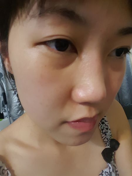 AMIINO安美諾高效抗痘凝膠