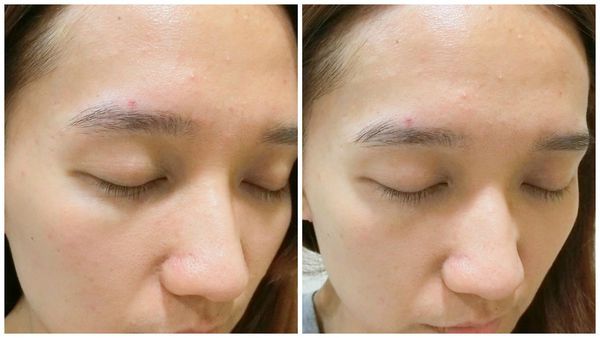 AMIINO安美諾高效抗痘凝膠