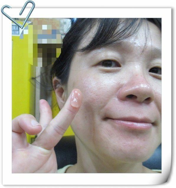 AMIINO安美諾高效抗痘凝膠