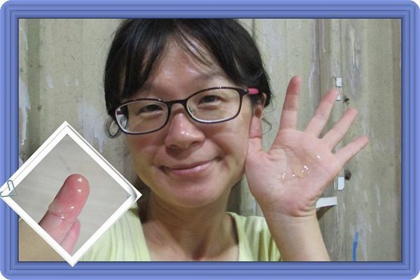 AMIINO安美諾高效抗痘凝膠