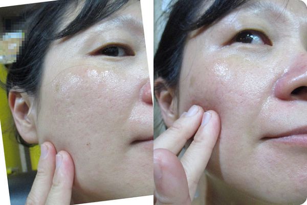 AMIINO安美諾高效抗痘凝膠