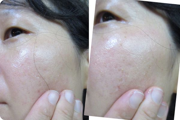 AMIINO安美諾高效抗痘凝膠