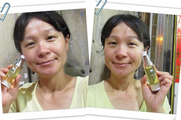 AMIINO安美諾高效抗痘凝膠