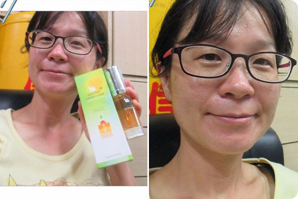 AMIINO安美諾高效抗痘凝膠