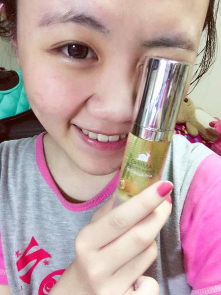 AMIINO安美諾高效抗痘凝膠