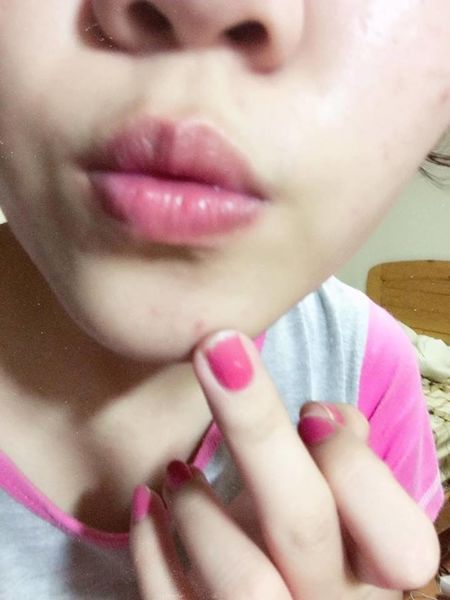 AMIINO安美諾高效抗痘凝膠