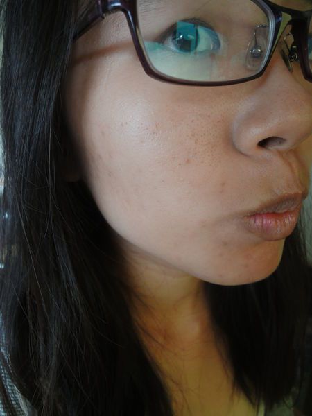 AMIINO安美諾高效抗痘凝膠