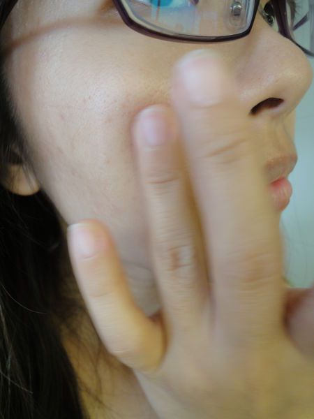 AMIINO安美諾高效抗痘凝膠