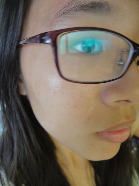 AMIINO安美諾高效抗痘凝膠