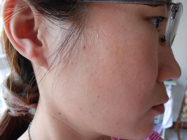 AMIINO安美諾高效抗痘凝膠