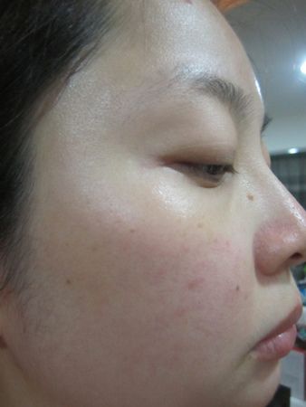 AMIINO安美諾高效抗痘凝膠