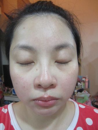 AMIINO安美諾高效抗痘凝膠