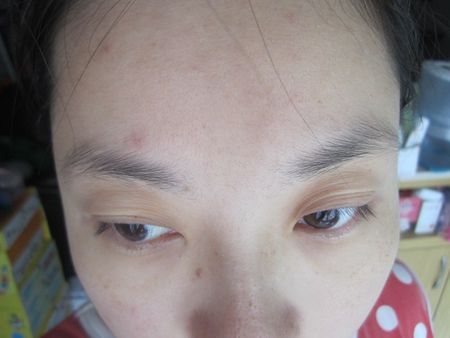 AMIINO安美諾高效抗痘凝膠