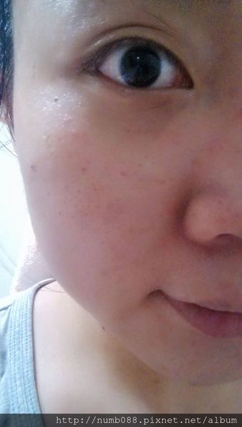 AMIINO安美諾高效抗痘凝膠