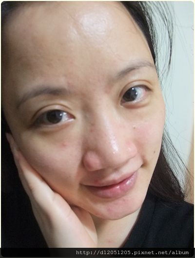 AMIINO安美諾高效抗痘凝膠