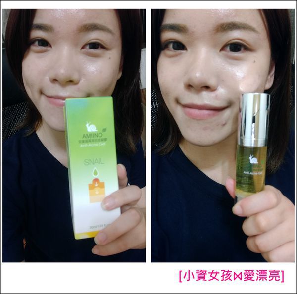 AMIINO安美諾高效抗痘凝膠